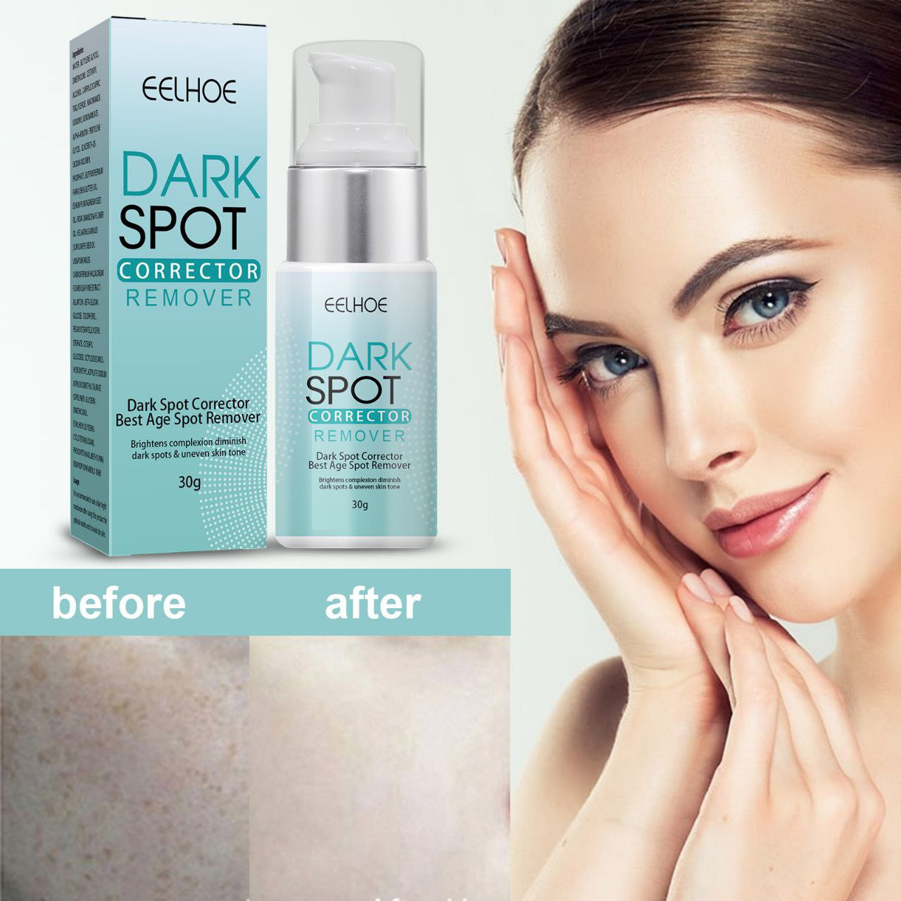 EELHOE crème anti-taches pour le visage hydratante et rajeunissante améliore les taches brunes et les taches soulage la mélanine de la peau du visage